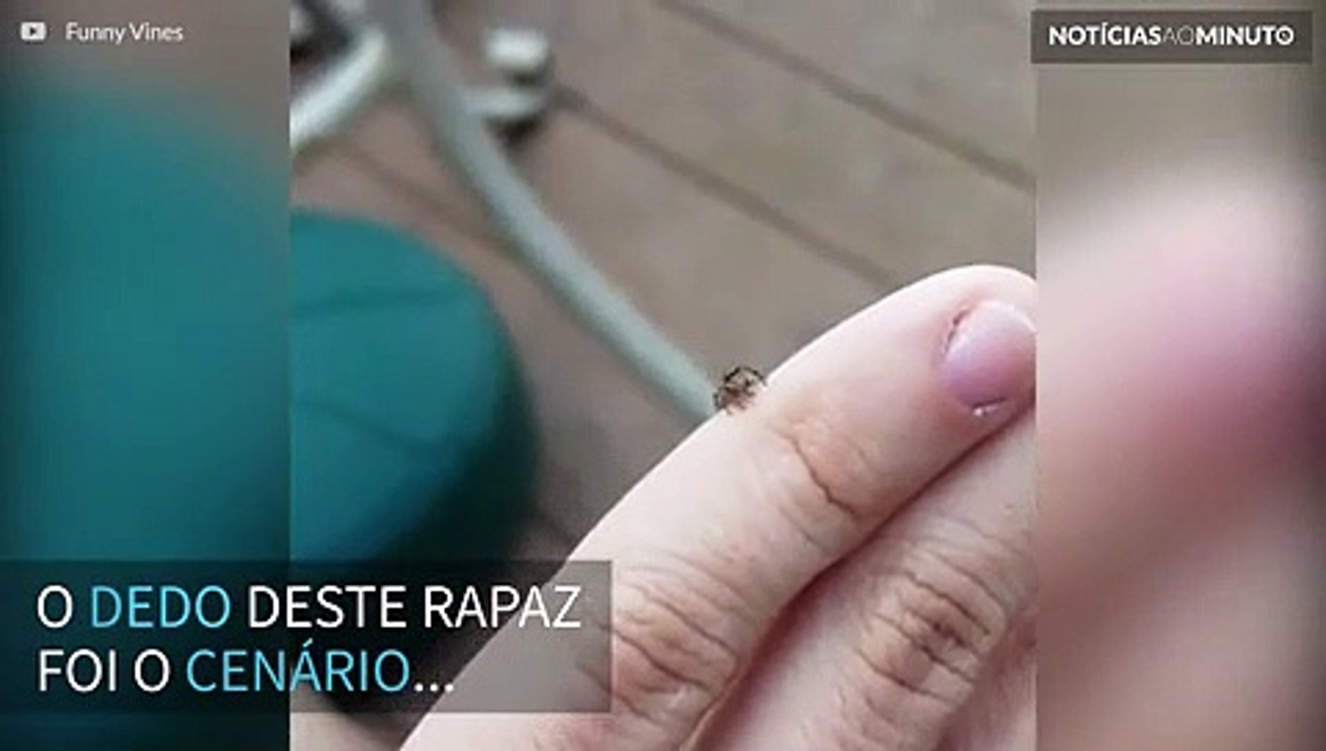 Homem filma aranha atacando vespa no próprio dedo
