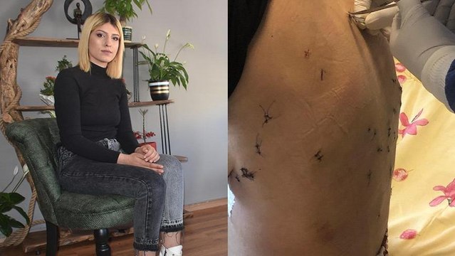 Boşanmak istediği eşi tarafından 38 yerinden bıçaklanan 2 çocuk annesi: ‘Bu son yemeğin’ diyerek bıçakladı