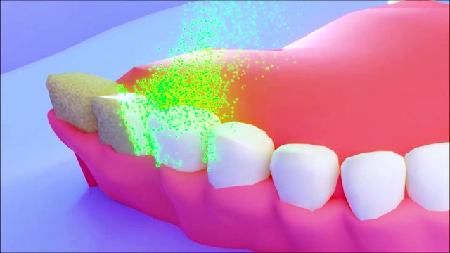 How Can You Whiten Your Teeth?