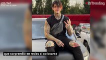 'Influencer' colombiano se pone implantes mamarios por reto de Instagram
