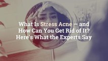 What Is Stress Acne—and How Can You Get Rid of It? Here’s What the Experts Say