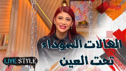 ما هو العلاج الأكثر فعالية للهالات السوداء؟