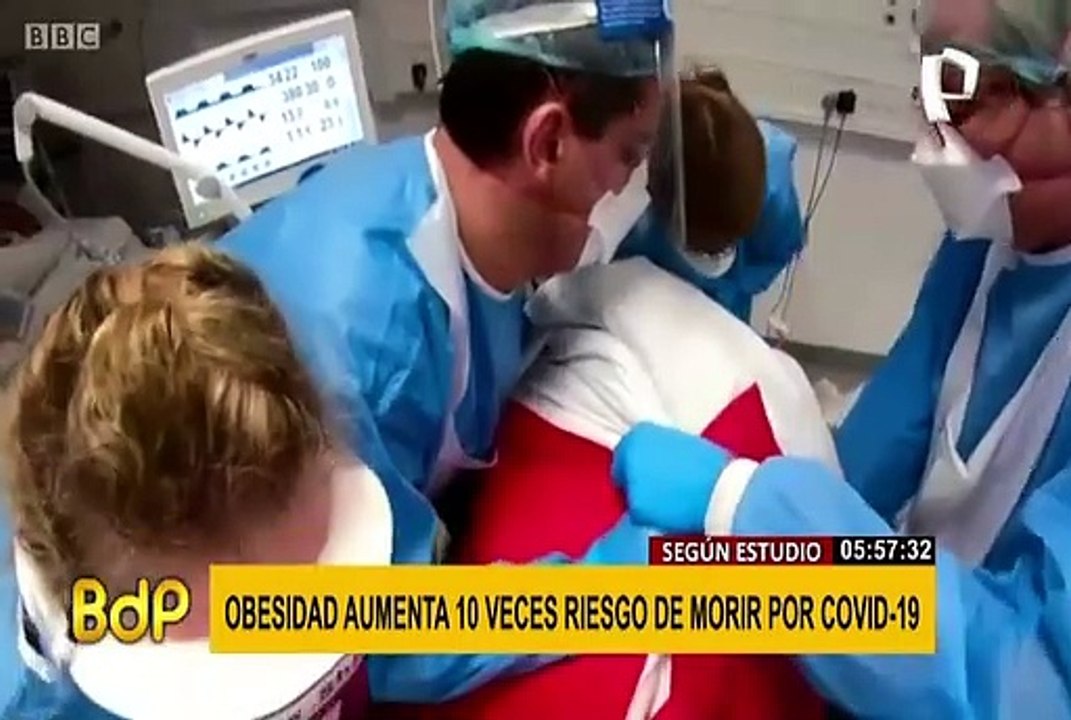 Obesidad aumenta hasta 10 veces el riesgo de morir por COVID-19, según estudio