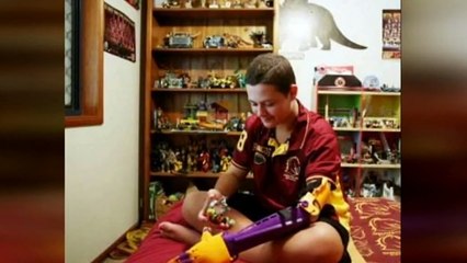 Student develops technology for computer controlled limbs