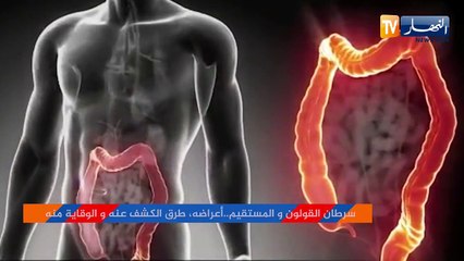 سرطان القولون والمستقيم.. أعراضه طرق الكشف عنه والوقاية منه