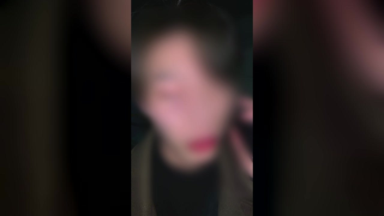 춘천 대학가에서 20대 남성에게 무차별 폭행...경찰 수사 / YTN