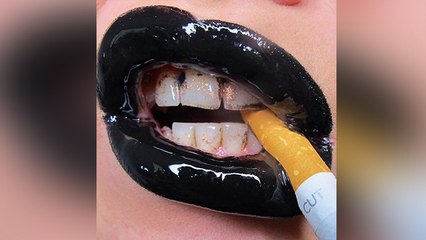 Smoking से काले पड़ गए हैं Lips, अपनाएं ये उपाय तुरंत मिलेगा फायदा | Boldsky
