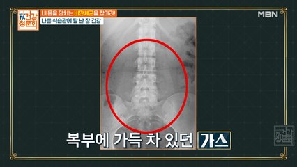 실뱀같은 변이 장의 위험 신호?