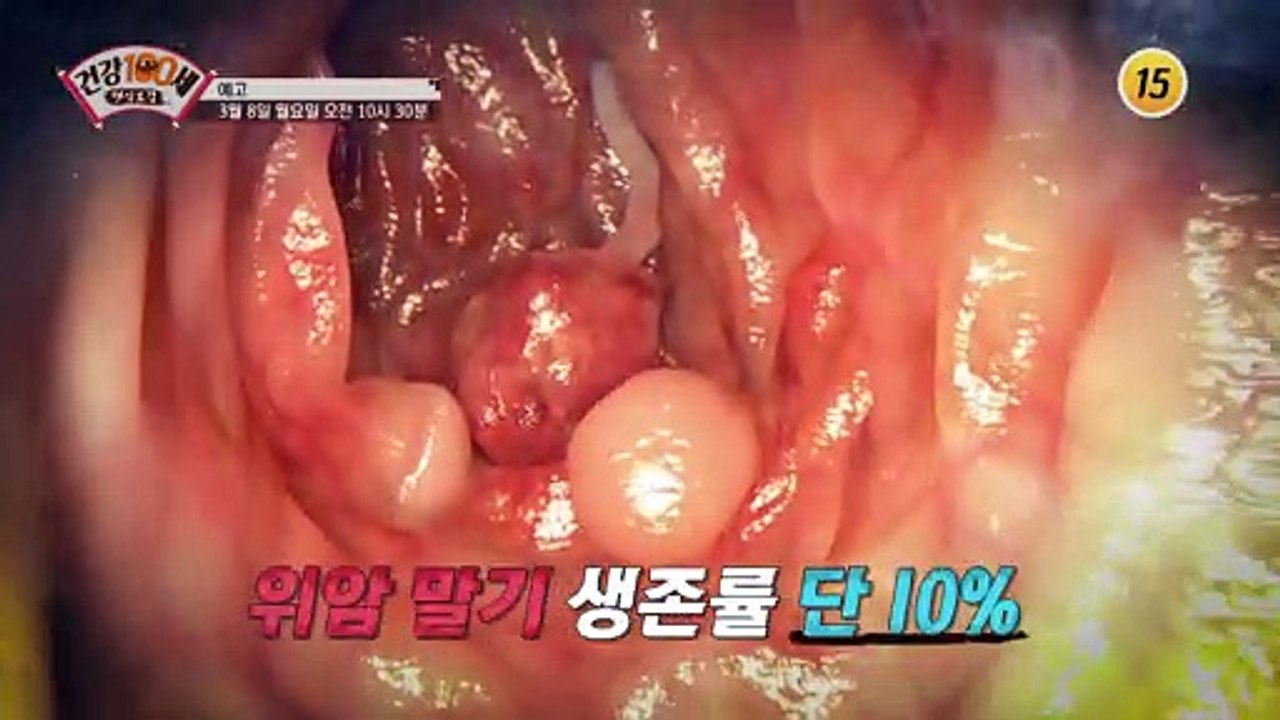 위암 4기를 극복할 수 있었던 기적의 비법은?_명심보감 29회 예고 TV CHOSUN...