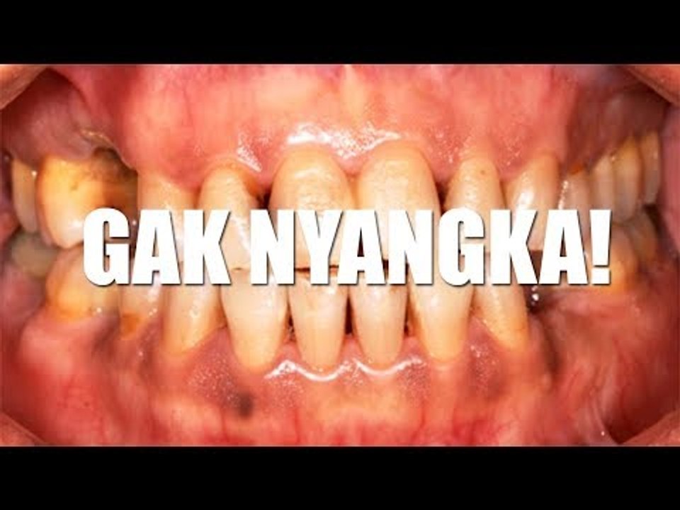 GAK NYANGKA..!! Makanan dan Minuman Ini Bisa Bi...
