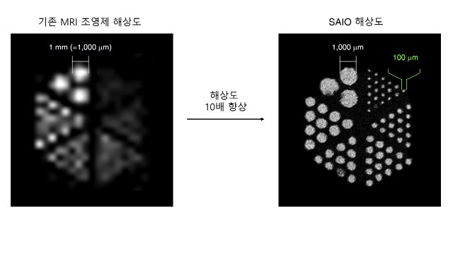 10배 더 정밀한 MRI 조영제 개발...머리카락 굵기 혈관도 관찰 / YTN