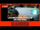 Los médicos extraen un pez vivo de la garganta de un pescador