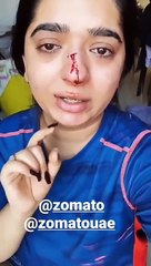 Zomato ऑर्डर कैंसिल करने पर आग-बबूला हुआ डिलिवरी ब्वॉय, महिला के चेहरे पर जड़ दिया पंच, वीडियो वायरल