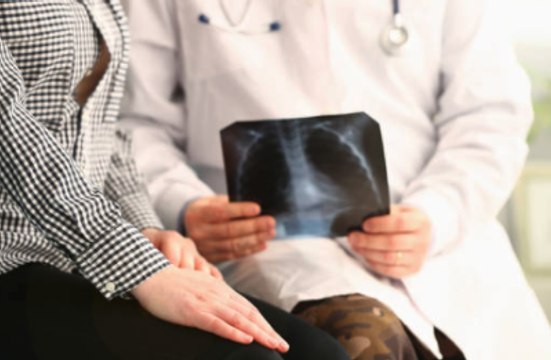 Panel Recommends Lung Cancer Scans for People 50 and up With Shorter Smoking Histories