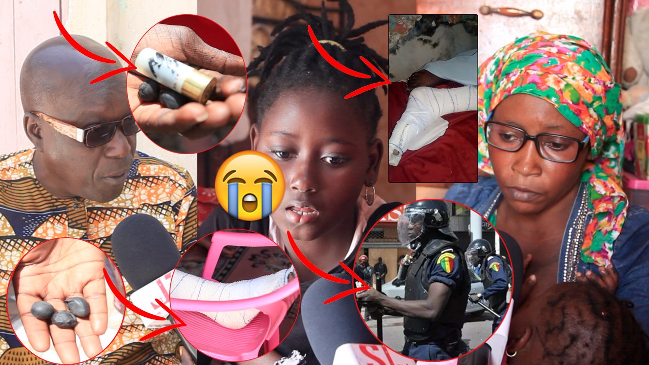 Colobane des gendarmes tirent sur une fille de 14ans par b@lle