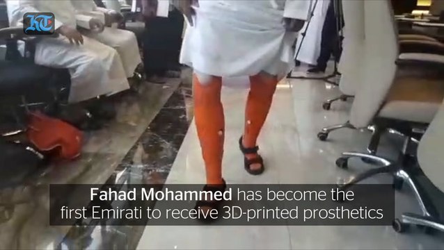 Emirati double amputee receives set of 3D-printed prosthetic legs