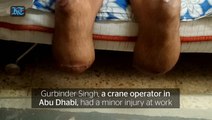 Indian expat loses both hands and legs after minor injury in Abu Dhabi