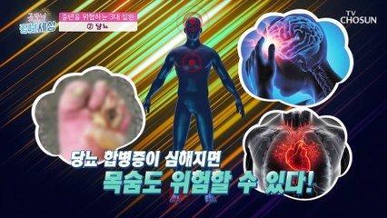 남자보다 여자에게 더 위협적인 질환의 정체는?! TV CHOSUN 210311 방송