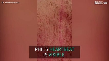 Man's heartbeat is visible to the naked eye
