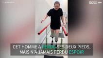 Cet homme dont les deux pieds ont été amputés, peut marcher à nouveau 1