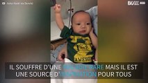 Après trois chirurgies, ce bébé atteint d'une rare maladie peut bouger ses muscles