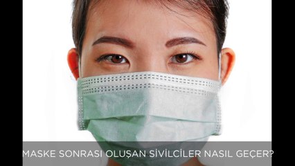 Maske oluşan sivilceler nasıl geçer?