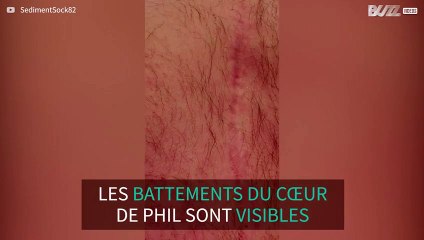 Les battements du cœur de cet homme sont visibles à l'œil nu