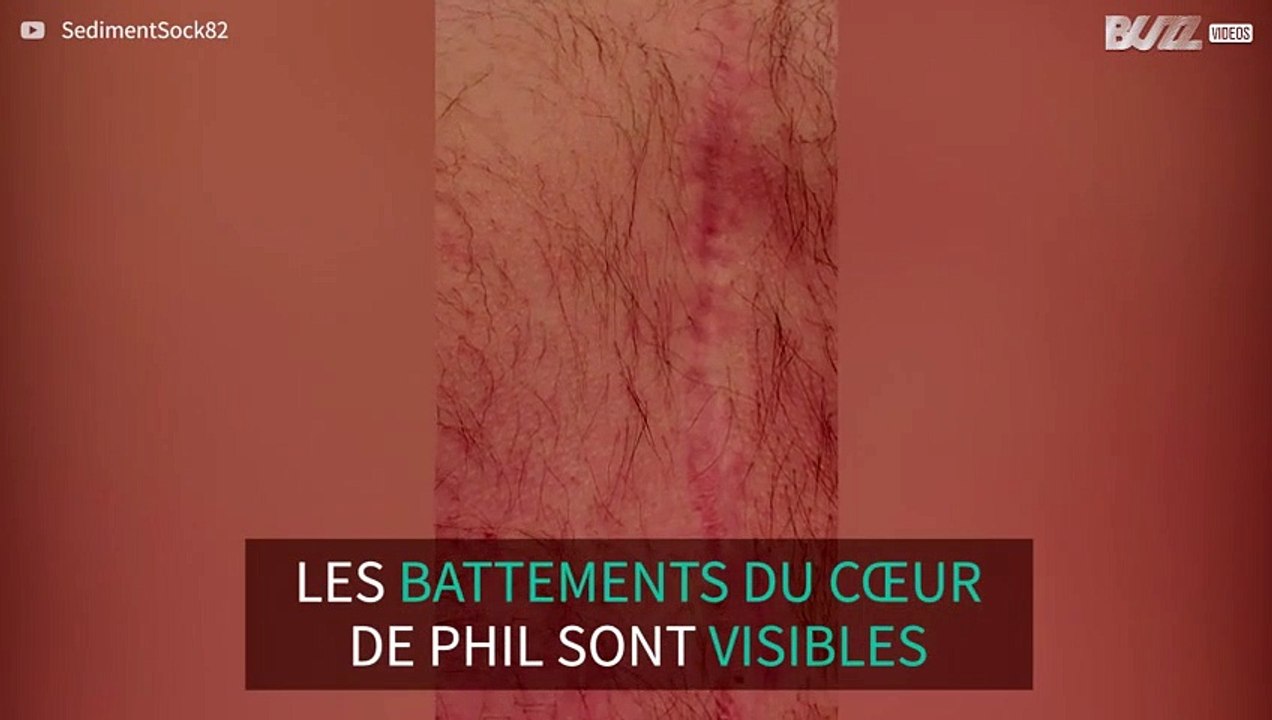 Les battements du cœur de cet homme sont visibles à l'œil nu