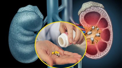 पेनकिलर्स खाने से क्या सच में होती है किडनी खराब ? | Kidney Failure due to Painkillers | Boldsky