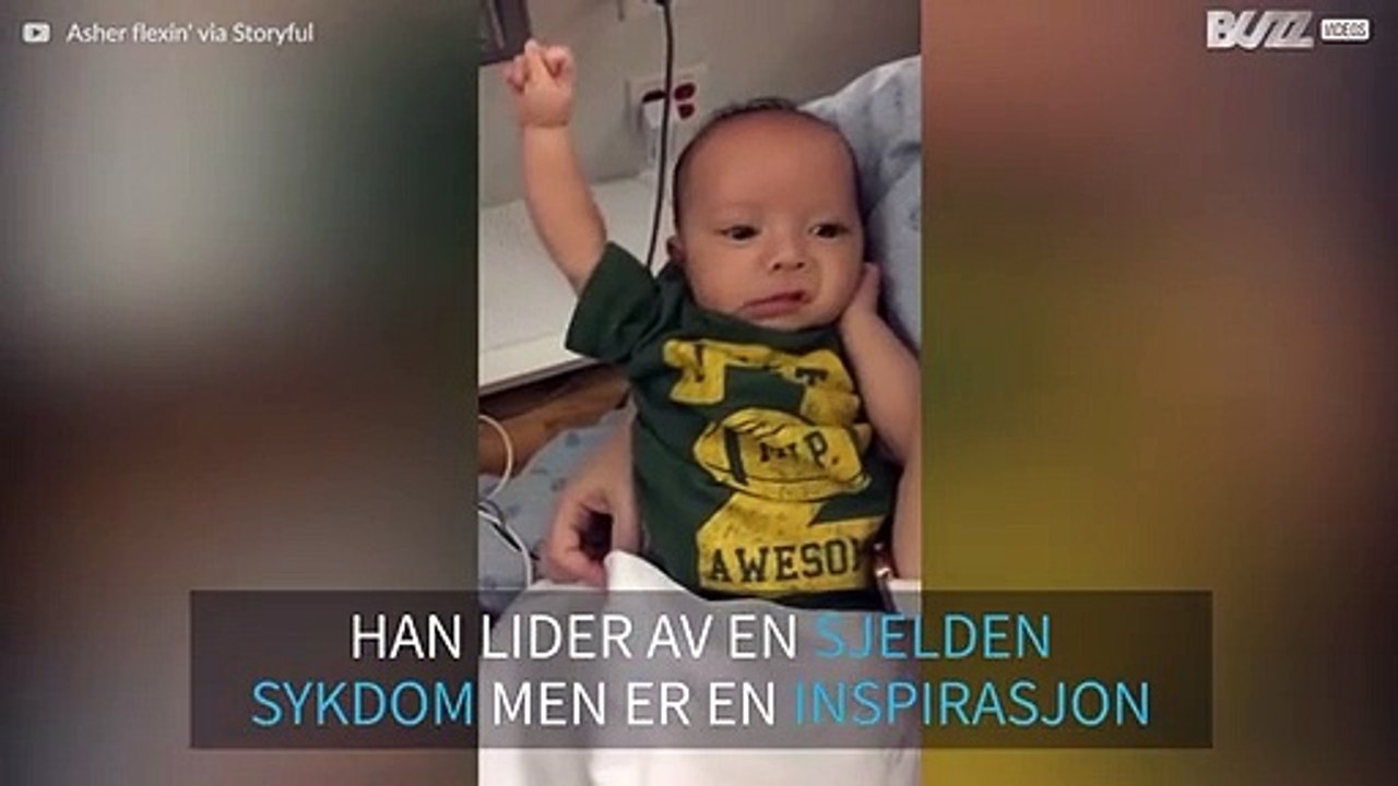 Etter tre operasjoner flekser en baby med en sjelden sykdom musklene sine