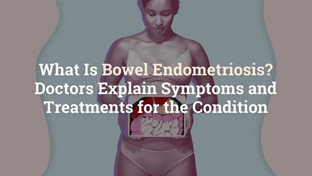 What Is Bowel Endometriosis? Doctors Explain Symptoms and Treatments for the Condition