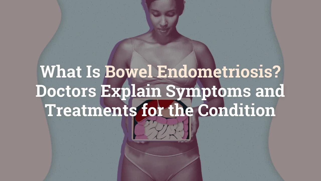 What Is Bowel Endometriosis? Doctors Explain Symptoms and Treatments for the Condition