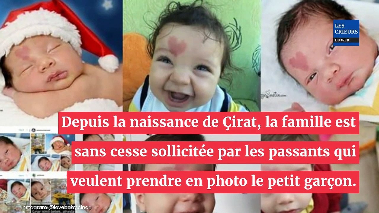 Un bébé naît avec une tâche de naissance en forme de coeur ! 5 ans plus tard, à quoi ressemble-t-il ?