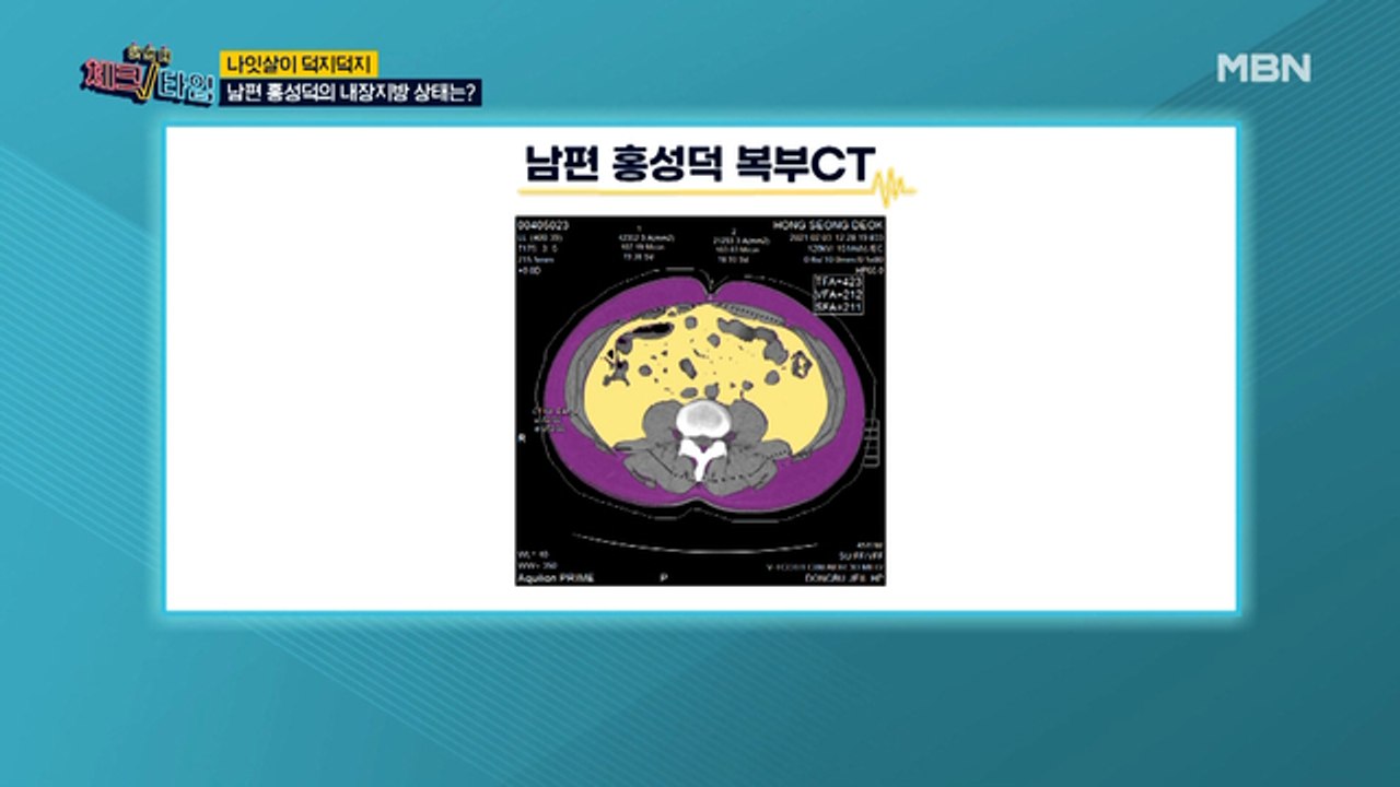 ※충격※ 김지현의 남편 홍성덕의 내장지방 상태는?
