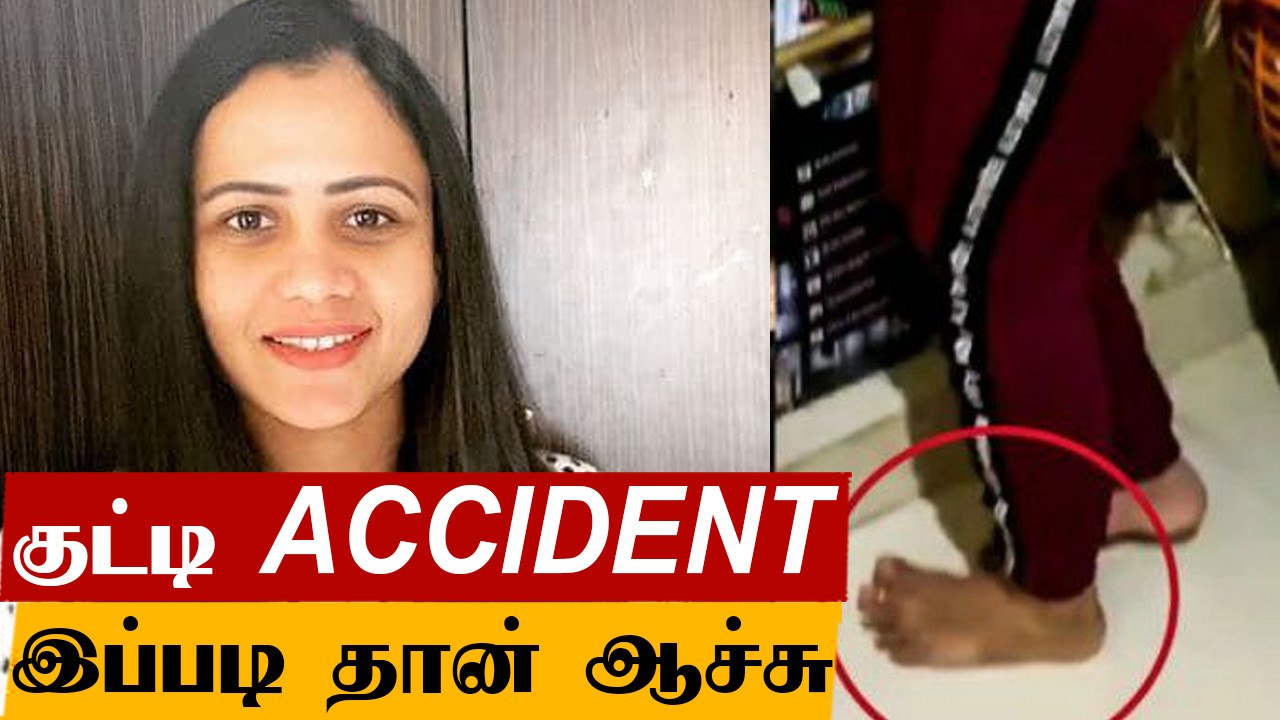 Manimegalai opensup | சுடுதண்ணீர் கொட்டி! விழுந்துட்டேன்  | Cook with Comali