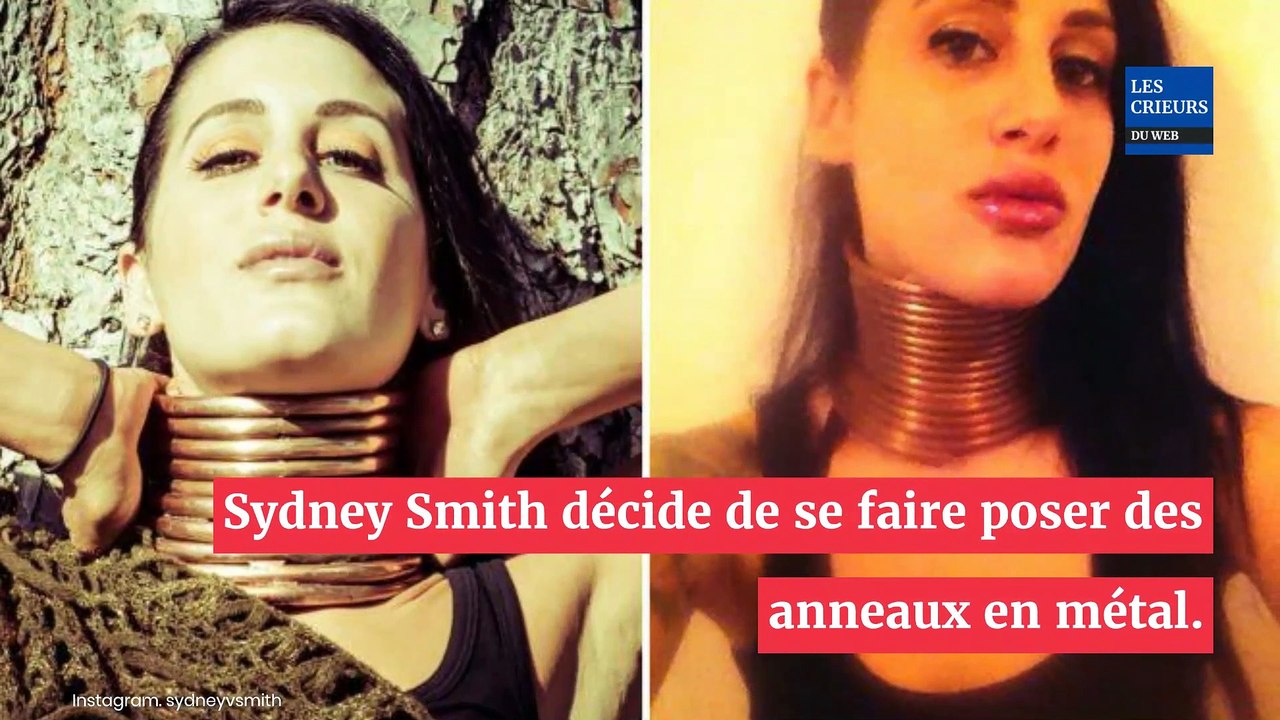 Elle porte des anneaux de cou pour devenir une « femme girafe » et les retire au bout de cinq ans