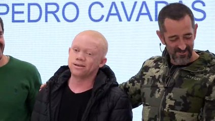 El doctor Cavadas opera a un guineano con cánceres múltiples de piel y "le regala una vida"