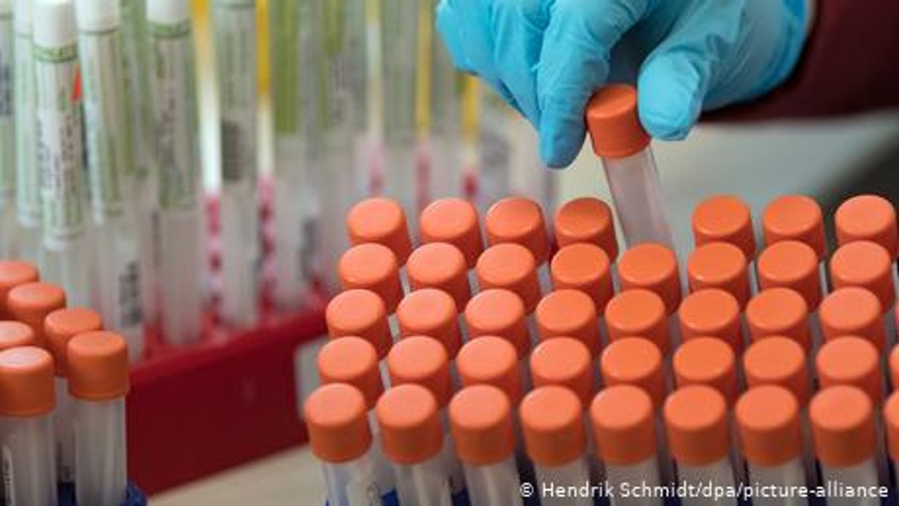 Pool-Testing - Ruandas Corona-Strategie