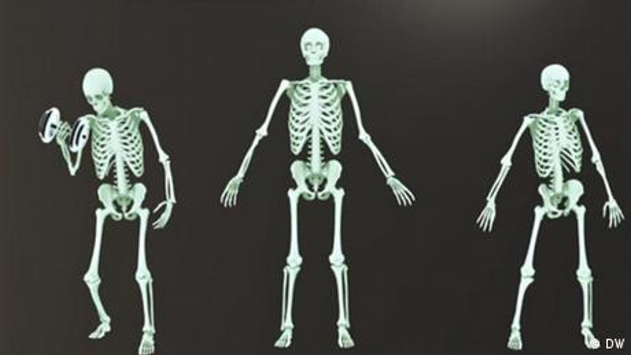 Knochen - kurz erklärt