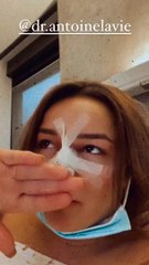 Victoria Mehault (Les Marseillais) s'offre de nouvelles opérations de chirurgie esthétique - Instagram