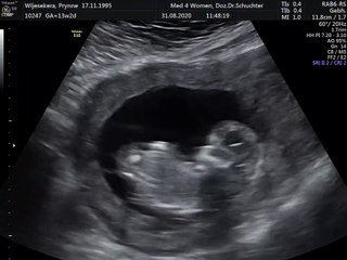 baby boy ultrasound