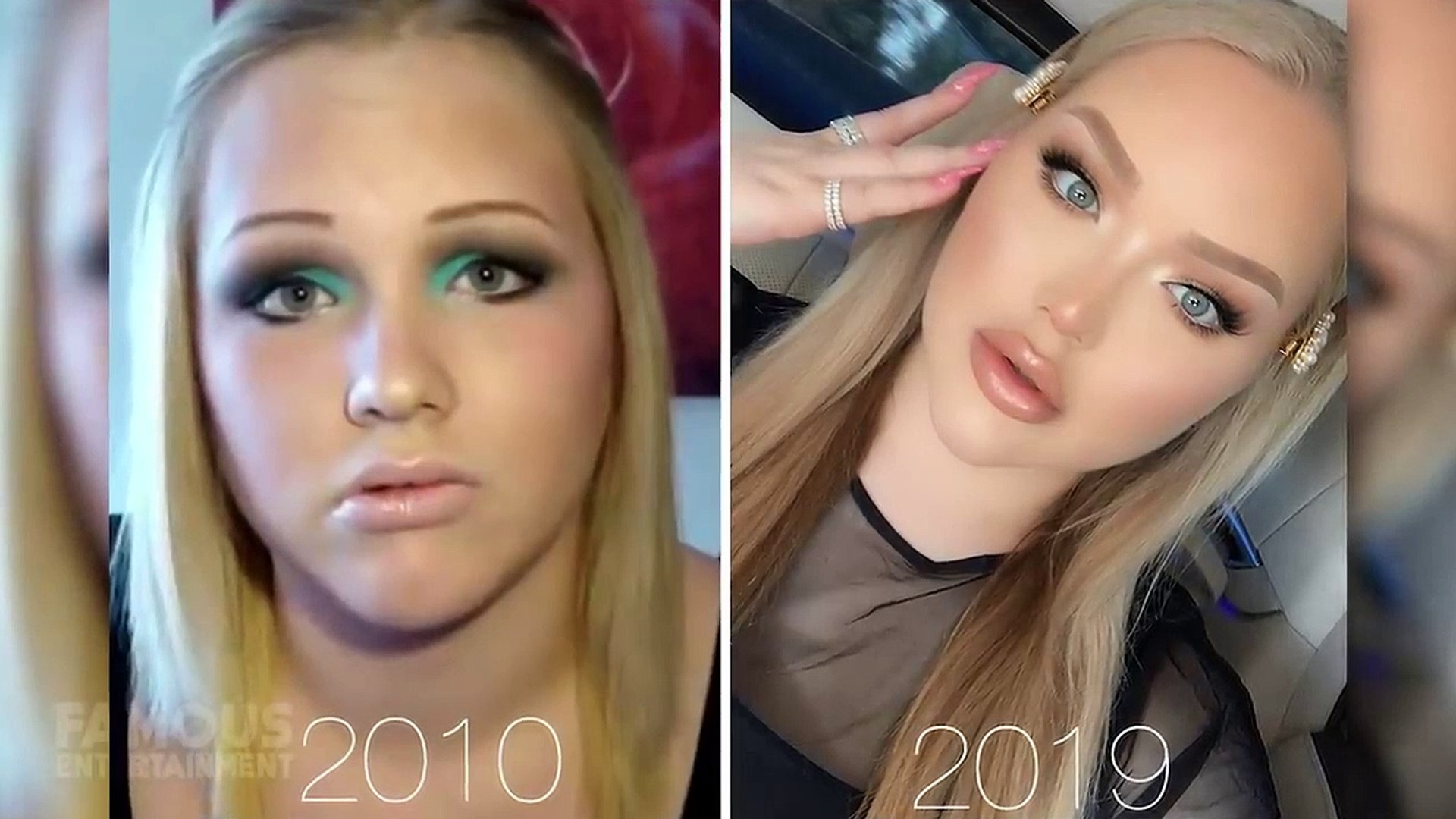 NikkieTutorials _ Before and After Transformations _ Her Cosmetic Surgery  and More - video Dailymotion