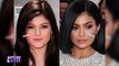 Kylie Jenner _ Before and After Transformations _ Plastic Surgery UPDATED