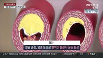 혈전 논란 AZ 백신…