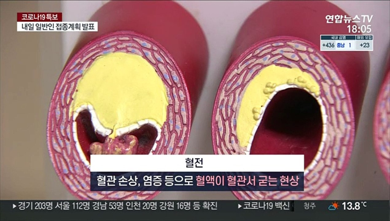 혈전 논란 AZ 백신…"인과성 아직…접종 계속"