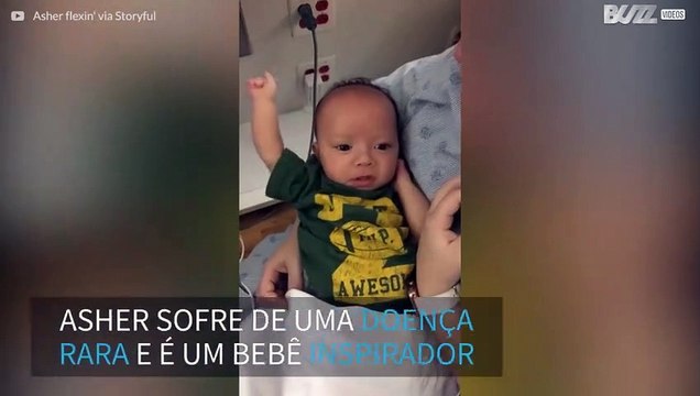 Após 3 cirurgias, bebê com doença rara mostra muque para mãe
