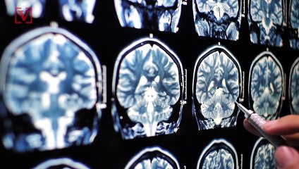 How This One Test Could Be The New Way To Detect Alzheimer’s