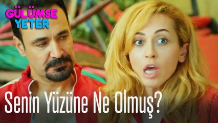 Senin yüzüne ne olmuş?