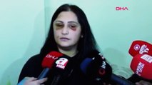 Samsun’da eski eşinin dövdüğü kadın: Şiddet sessiz kalındıkça çoğalıyor