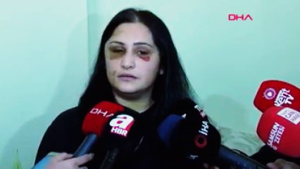 Video herunterladen: Samsun’da eski eşinin dövdüğü kadın: Şiddet sessiz kalındıkça çoğalıyor